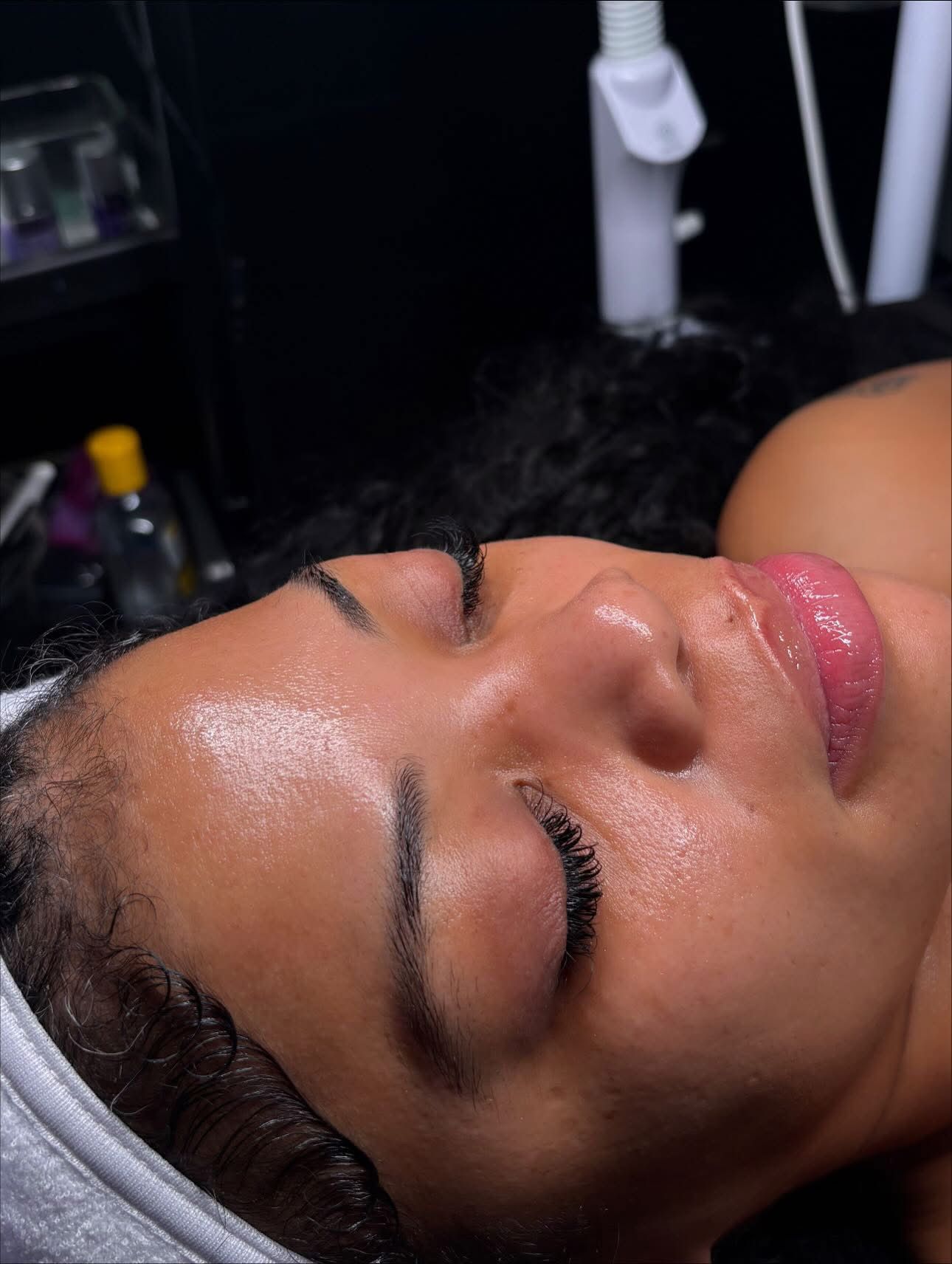 Esthetic treatment in Overland Park